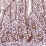 BRAF35 Antibody in Immunohistochemistry (Paraffin) (IHC (P))