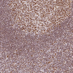 Histone H2A.Z Antibody in Immunohistochemistry (Paraffin) (IHC (P))