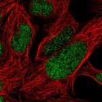 FOXP2 Antibody in Immunocytochemistry (ICC/IF)