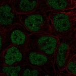 TBX3 Polyclonal Antibody