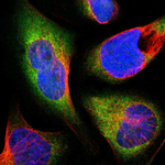 THRA Polyclonal Antibody