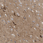 THRA Antibody in Immunohistochemistry (Paraffin) (IHC (P))