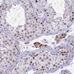 TEAD4 Antibody in Immunohistochemistry (Paraffin) (IHC (P))