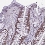 TEAD4 Antibody in Immunohistochemistry (Paraffin) (IHC (P))