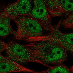 SREBP2 Antibody in Immunocytochemistry (ICC/IF)