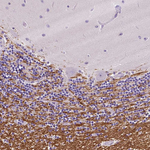 SIRT2 Antibody in Immunohistochemistry (Paraffin) (IHC (P))
