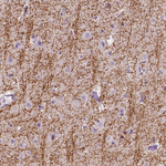 SIRT2 Antibody in Immunohistochemistry (Paraffin) (IHC (P))