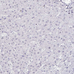 SIN3A Antibody in Immunohistochemistry (Paraffin) (IHC (P))