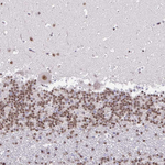 SIN3A Antibody in Immunohistochemistry (Paraffin) (IHC (P))