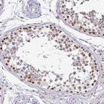 SIN3A Antibody in Immunohistochemistry (Paraffin) (IHC (P))