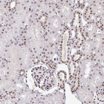 SIN3A Antibody in Immunohistochemistry (Paraffin) (IHC (P))