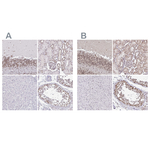 SIN3A Antibody in Immunohistochemistry (Paraffin) (IHC (P))
