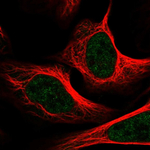 TRAP220 Polyclonal Antibody