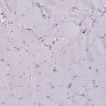PSMB8 Antibody in Immunohistochemistry (Paraffin) (IHC (P))