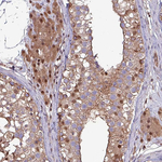 PSMB8 Antibody in Immunohistochemistry (Paraffin) (IHC (P))