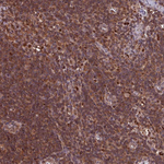 PSMB8 Antibody in Immunohistochemistry (Paraffin) (IHC (P))