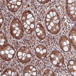 PSMB8 Antibody in Immunohistochemistry (Paraffin) (IHC (P))