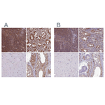 PSMB8 Antibody in Immunohistochemistry (Paraffin) (IHC (P))