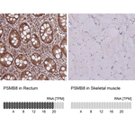 PSMB8 Antibody in Immunohistochemistry (Paraffin) (IHC (P))