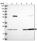 PSMB8 Antibody in Western Blot (WB)