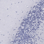 ADAP Antibody in Immunohistochemistry (Paraffin) (IHC (P))