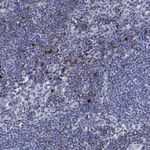 ADAP Antibody in Immunohistochemistry (Paraffin) (IHC (P))