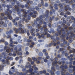 ADAP Antibody in Immunohistochemistry (Paraffin) (IHC (P))