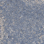 CDCP1 Antibody in Immunohistochemistry (Paraffin) (IHC (P))