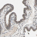CDCP1 Antibody in Immunohistochemistry (Paraffin) (IHC (P))