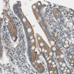 CDCP1 Antibody in Immunohistochemistry (Paraffin) (IHC (P))