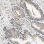 CDCP1 Antibody in Immunohistochemistry (Paraffin) (IHC (P))