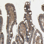 CDCP1 Antibody in Immunohistochemistry (Paraffin) (IHC (P))