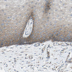 CDCP1 Antibody in Immunohistochemistry (Paraffin) (IHC (P))