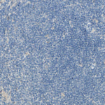 CDCP1 Antibody in Immunohistochemistry (Paraffin) (IHC (P))