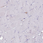 PSMB8 Antibody in Immunohistochemistry (Paraffin) (IHC (P))
