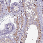 PSMB8 Antibody in Immunohistochemistry (Paraffin) (IHC (P))