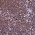 PSMB8 Antibody in Immunohistochemistry (Paraffin) (IHC (P))