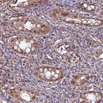 PSMB8 Antibody in Immunohistochemistry (Paraffin) (IHC (P))
