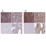 PSMB8 Antibody in Immunohistochemistry (Paraffin) (IHC (P))