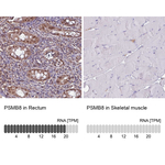 PSMB8 Antibody in Immunohistochemistry (Paraffin) (IHC (P))