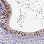 PAX2 Antibody in Immunohistochemistry (Paraffin) (IHC (P))