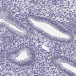 PAX2 Antibody in Immunohistochemistry (Paraffin) (IHC (P))