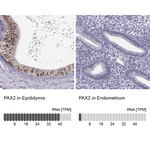 PAX2 Polyclonal Antibody