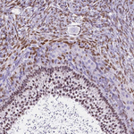 FOXL2 Antibody in Immunohistochemistry (Paraffin) (IHC (P))
