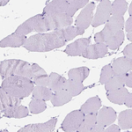 FOXL2 Antibody in Immunohistochemistry (Paraffin) (IHC (P))