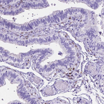 FOXL2 Antibody in Immunohistochemistry (Paraffin) (IHC (P))