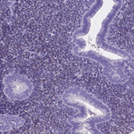 FOXL2 Antibody in Immunohistochemistry (Paraffin) (IHC (P))