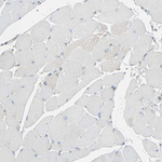 PRDX1 Antibody in Immunohistochemistry (Paraffin) (IHC (P))