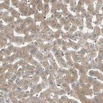 PRDX1 Antibody in Immunohistochemistry (Paraffin) (IHC (P))