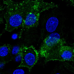 Glypican 3 Polyclonal Antibody